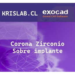 Corona Zirconio Sobre implante