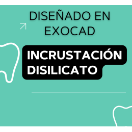 Incrustación Disilicato