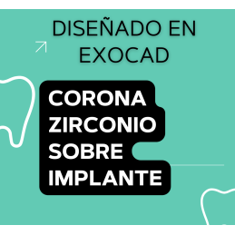 Corona Zirconio Sobre implante